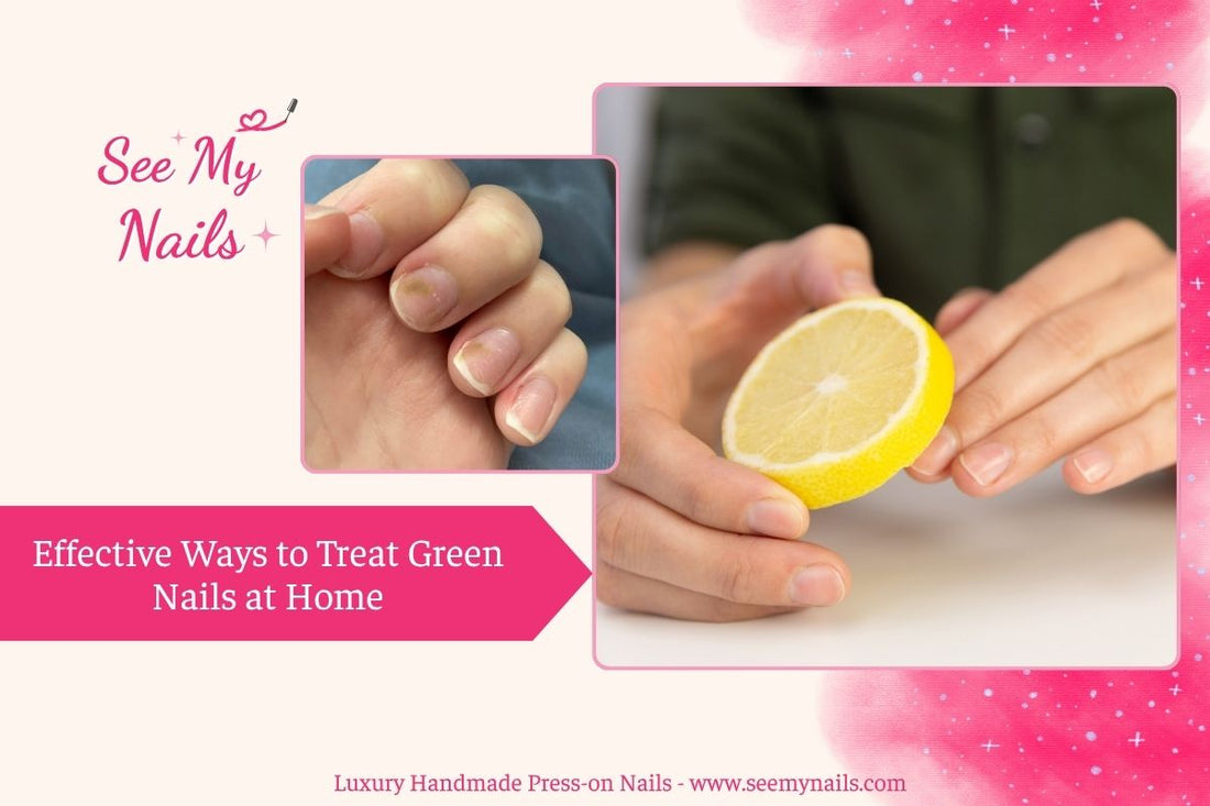 5 Effective Ways to Treat Green Nails at Home